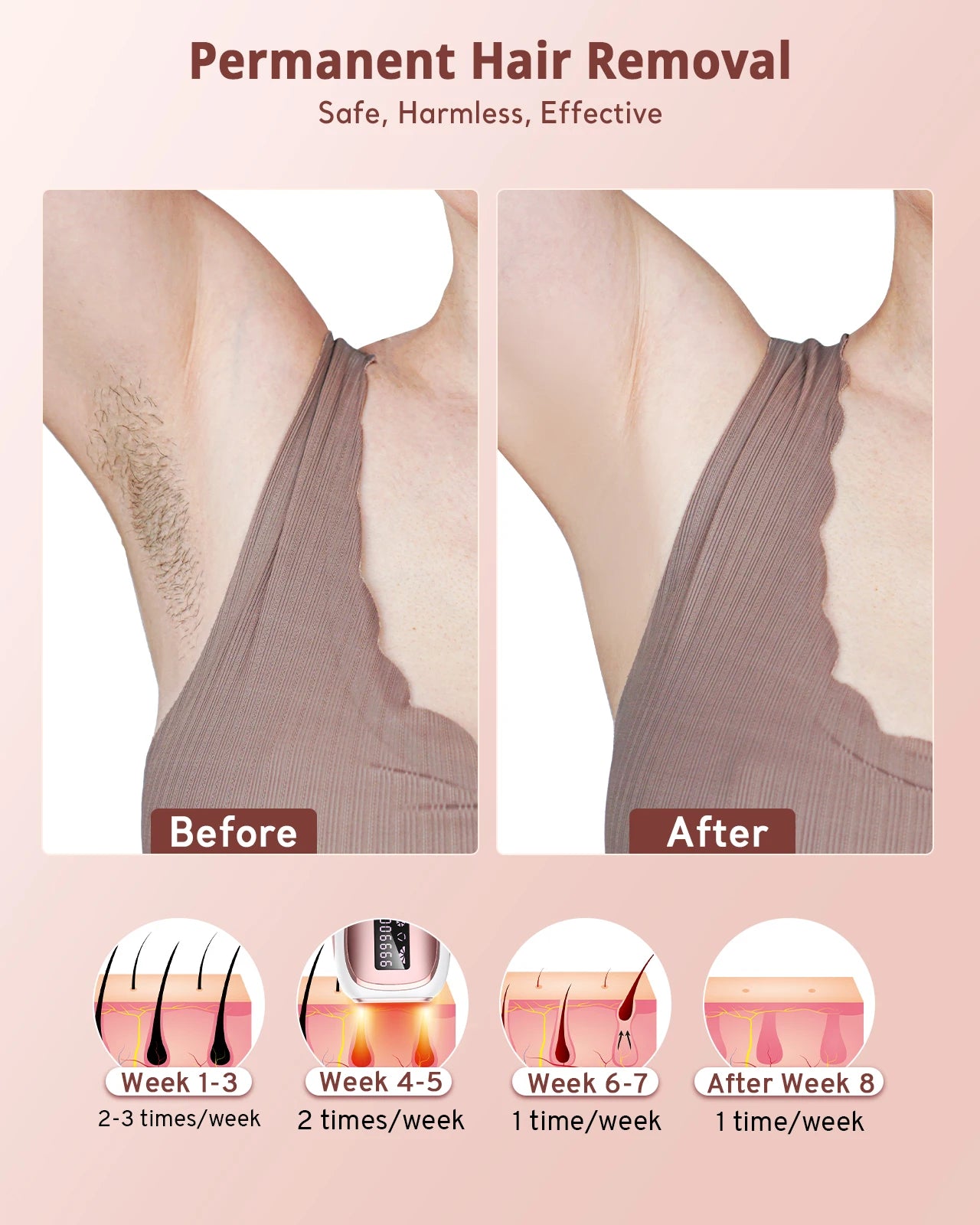 Ice Cooling IPL Hair Removal Women Men Upgraded 999,900 Flashes 5